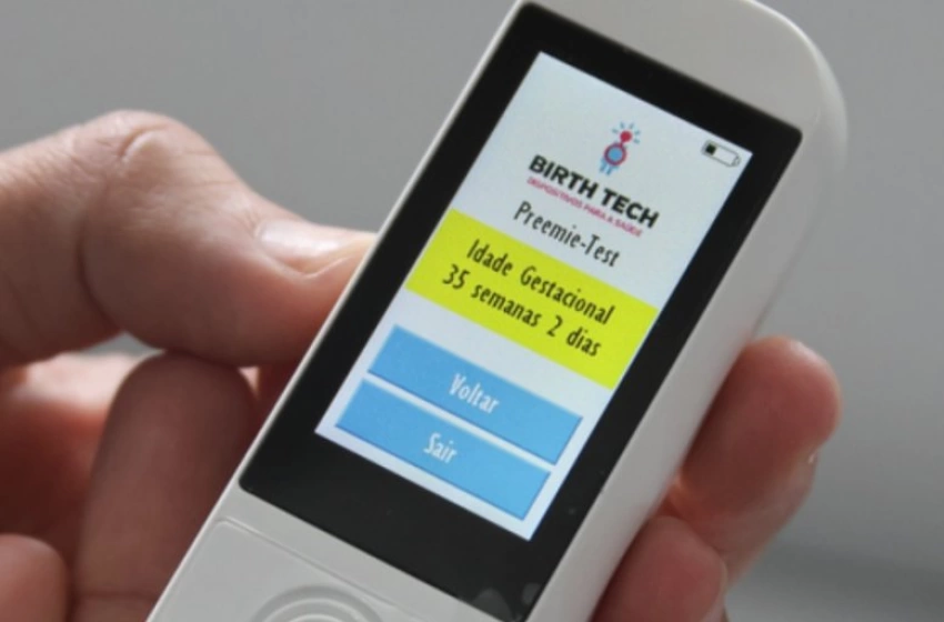 Imagem SUS adota inovação brasileira que usa pele dos pés para avaliar saúde de prematuros