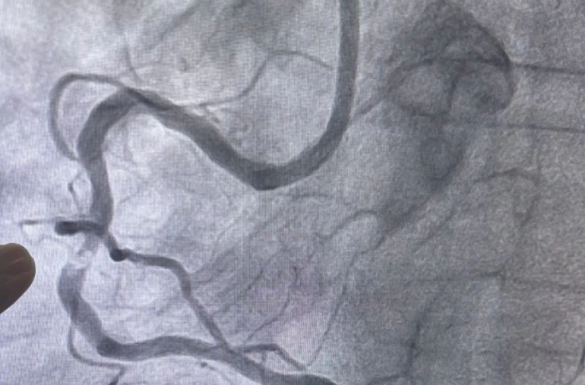 Imagem Primeiro procedimento com RotaPro do SUS na Paraíba