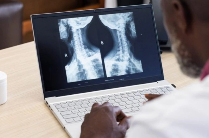 Imagem Implementada em 2024, telerradiologia em hospitais federais já fez mais de 500 mil exames