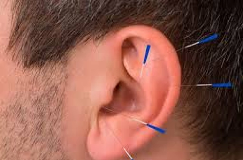 Imagem auriculoterapia