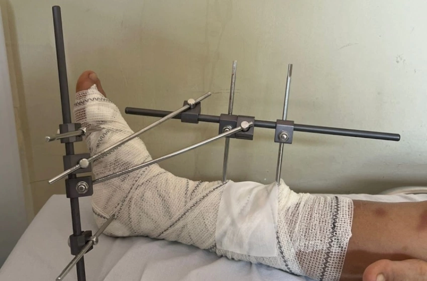 Imagem Cirurgia em Danuzia Tarciana de Oliveira, 49 anos, mais conhecida como ‘Branquinha’, vítima de atropelamento 