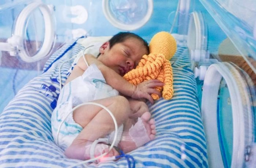 Imagem Polvo de crochê no tratamento de bebês prematuros