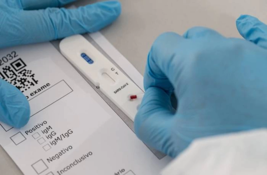 Imagem Testes Rápidos