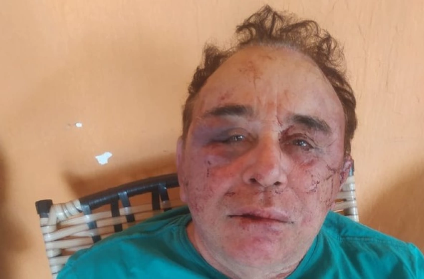 Imagem Arimateia Camboim