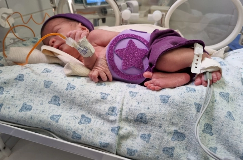 Imagem Contato pele a pele acelera desenvolvimento de bebês prematuros no Hospital Edson Ramalho