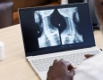 Implementada em 2024, telerradiologia em hospitais federais já fez mais de 500 mil exames