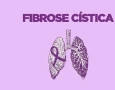 Fibrose Cística 